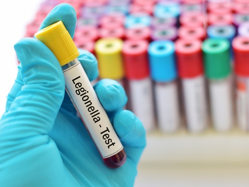 Legionella test Legionella testing